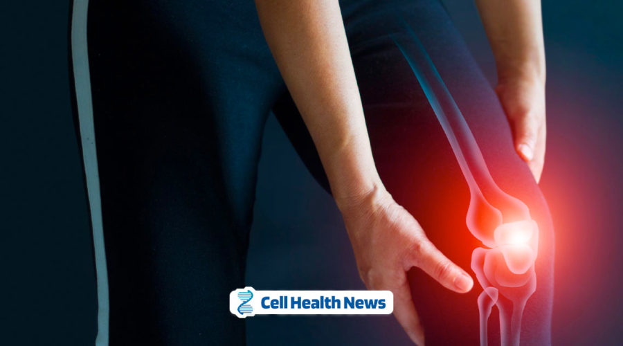 Natural Solutions for Joint Pain: Lifestyle and Supplements