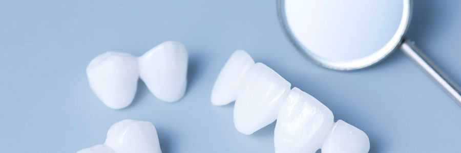 The Truth About Crowns and Implants: The Pros, Cons, and Problems
