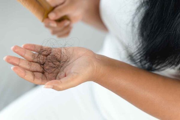 Beyond Minoxidil: Natural Solutions for Hair Loss