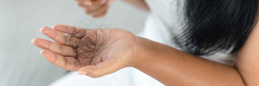 Beyond Minoxidil: Natural Solutions for Hair Loss