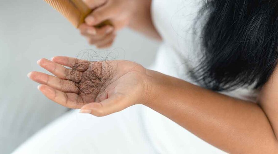 Beyond Minoxidil: Natural Solutions for Hair Loss